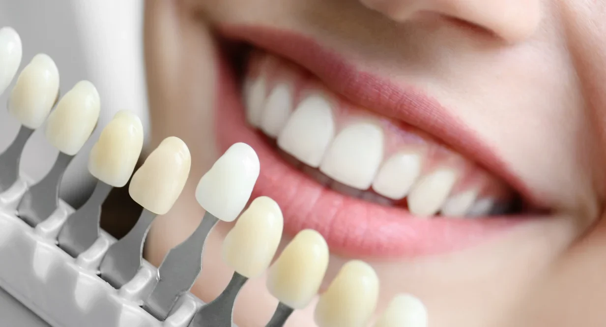 Whitening